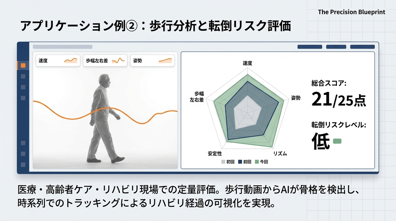 アプリケーション例②：歩行分析と転倒リスク評価 — 速度・リズム・安定性の5項目25点満点スコア